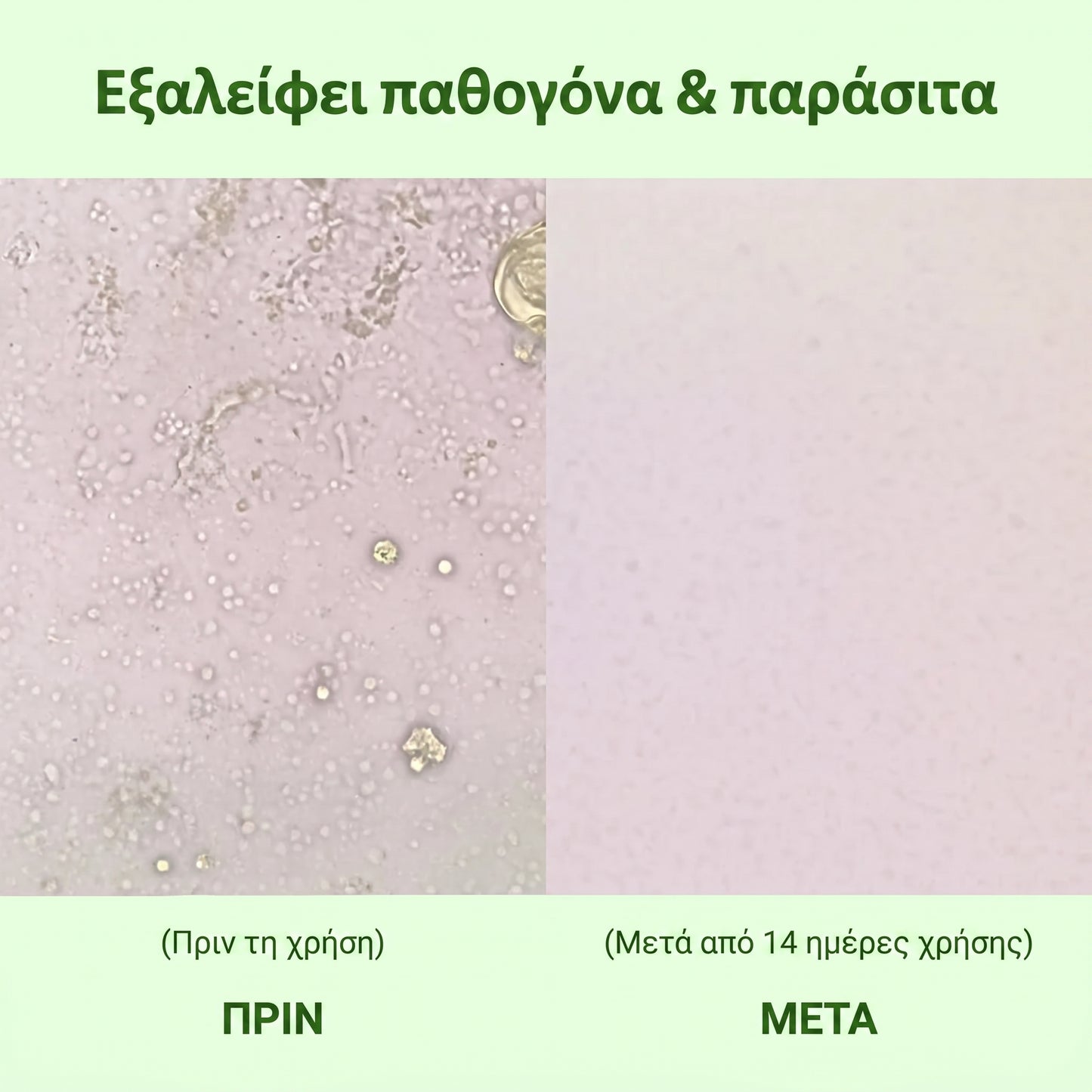 Zrevnika Origana — 1+1 ΔΩΡΕΑΝ (Θεραπεία 6 μηνών)