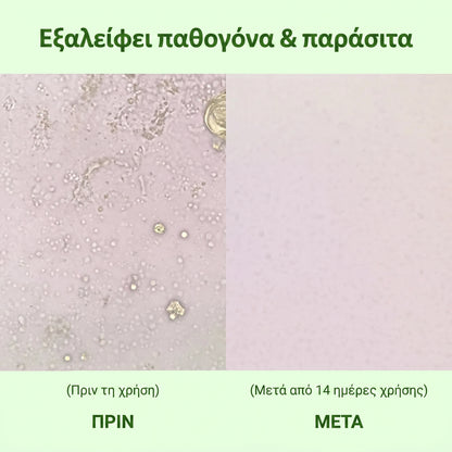 Zrevnika Origana — 1+1 ΔΩΡΕΑΝ (Θεραπεία 6 μηνών)